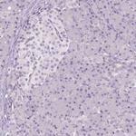 SLC6A19 Antibody in Immunohistochemistry (Paraffin) (IHC (P))