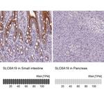 SLC6A19 Antibody in Immunohistochemistry (IHC)