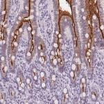 SLC6A19 Antibody in Immunohistochemistry (IHC)