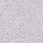 ACSS1 Antibody in Immunohistochemistry (Paraffin) (IHC (P))