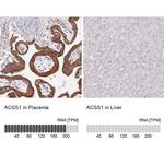 ACSS1 Antibody in Immunohistochemistry (IHC)