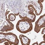 ACSS1 Antibody in Immunohistochemistry (IHC)