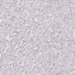 ACSS1 Antibody in Immunohistochemistry (IHC)