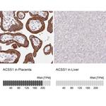 ACSS1 Antibody