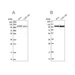 RBM12 Antibody in Western Blot (WB)