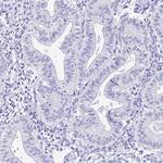 HSP701L Antibody in Immunohistochemistry (Paraffin) (IHC (P))