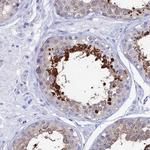 HSP701L Antibody in Immunohistochemistry (Paraffin) (IHC (P))