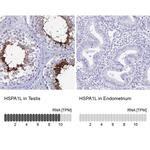 HSP701L Antibody in Immunohistochemistry (IHC)