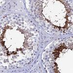 HSP701L Antibody in Immunohistochemistry (IHC)