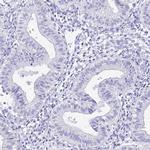 HSP701L Antibody in Immunohistochemistry (IHC)