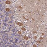 PEX16 Antibody in Immunohistochemistry (Paraffin) (IHC (P))