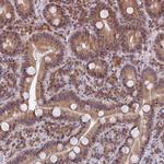 PEX16 Antibody in Immunohistochemistry (Paraffin) (IHC (P))