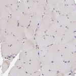 PEX16 Antibody in Immunohistochemistry (Paraffin) (IHC (P))