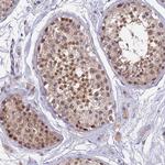 PEX16 Antibody in Immunohistochemistry (Paraffin) (IHC (P))