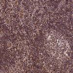 CABIN1 Antibody in Immunohistochemistry (Paraffin) (IHC (P))