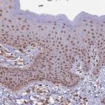 CABIN1 Antibody in Immunohistochemistry (Paraffin) (IHC (P))