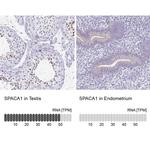 SPACA1 Antibody in Immunohistochemistry (IHC)