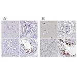 SPACA1 Antibody in Immunohistochemistry (IHC)