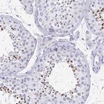 SPACA1 Antibody in Immunohistochemistry (IHC)