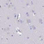 SPACA1 Antibody in Immunohistochemistry (IHC)