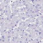 SPACA1 Antibody in Immunohistochemistry (IHC)