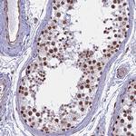 ALG10 Antibody in Immunohistochemistry (Paraffin) (IHC (P))