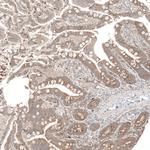 CPNE7 Antibody in Immunohistochemistry (Paraffin) (IHC (P))