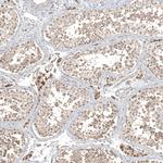 CPNE7 Antibody in Immunohistochemistry (Paraffin) (IHC (P))