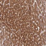 ZNF584 Antibody in Immunohistochemistry (Paraffin) (IHC (P))