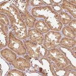 FUT8 Antibody in Immunohistochemistry (Paraffin) (IHC (P))