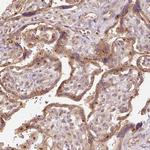 FUT8 Antibody in Immunohistochemistry (Paraffin) (IHC (P))