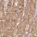 FUT8 Antibody in Immunohistochemistry (Paraffin) (IHC (P))