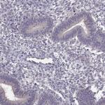 ACSBG2 Antibody in Immunohistochemistry (IHC)