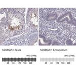 ACSBG2 Antibody