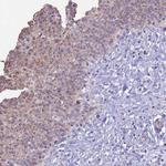 KRR1 Antibody in Immunohistochemistry (Paraffin) (IHC (P))