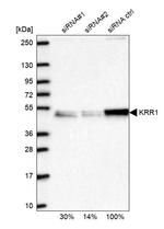 KRR1 Antibody in Western Blot (WB)