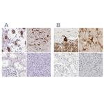 C1orf96 Antibody in Immunohistochemistry (IHC)