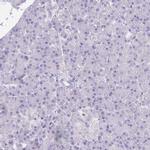 C1orf96 Antibody in Immunohistochemistry (IHC)