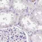 C1orf96 Antibody in Immunohistochemistry (IHC)