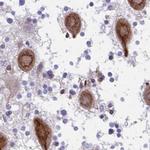 C1orf96 Antibody in Immunohistochemistry (IHC)