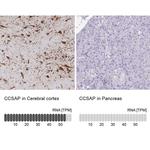 C1orf96 Antibody