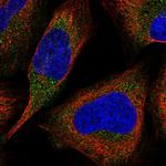 LZTFL1 Antibody in Immunocytochemistry (ICC/IF)