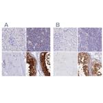 LZTFL1 Antibody in Immunohistochemistry (IHC)