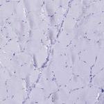 LZTFL1 Antibody in Immunohistochemistry (IHC)