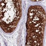 LZTFL1 Antibody in Immunohistochemistry (IHC)