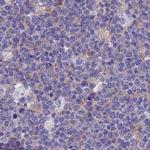 LZTFL1 Antibody in Immunohistochemistry (IHC)