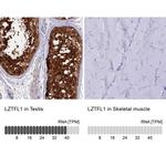 LZTFL1 Antibody