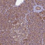 MRPS9 Antibody in Immunohistochemistry (IHC)