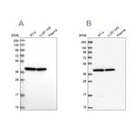 MRPS9 Antibody in Western Blot (WB)