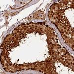 MICALL1 Antibody in Immunohistochemistry (Paraffin) (IHC (P))